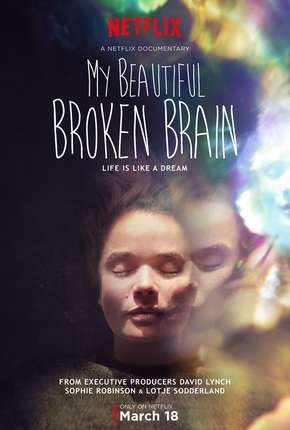 My Beautiful Broken Brain 2016 Torrent