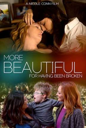 More Beautiful for Having Been Broken - Legendado 2020 Torrent